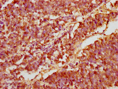 GANC Antibody