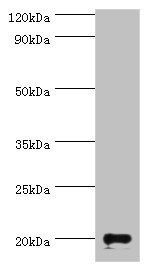 Ganglioside GM2 activator antibody