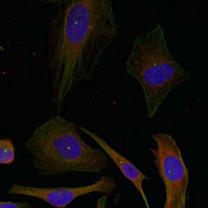 GAP43 (Ab-41) Antibody