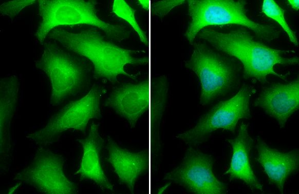 glyceraldehyde-3-phosphate dehydrogenase Antibody