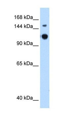 GAPVD1 antibody
