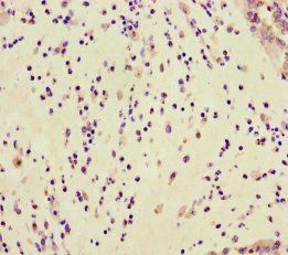 GAR1 antibody