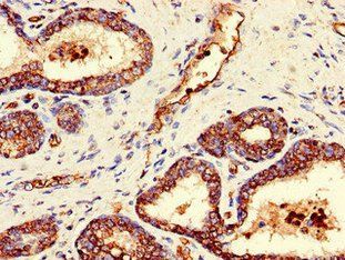 GAREM1 Antibody