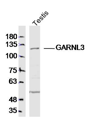 GARNL3 antibody