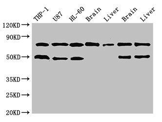 GARS antibody