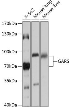 GARS antibody