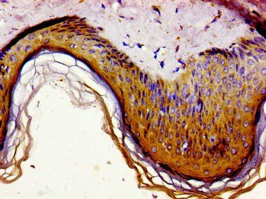 GAS1 Antibody