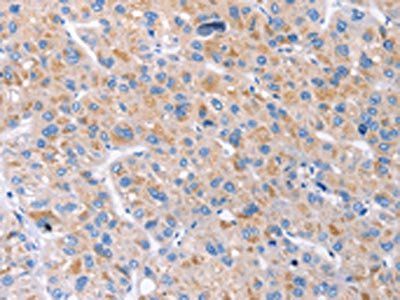 GAS1 Antibody