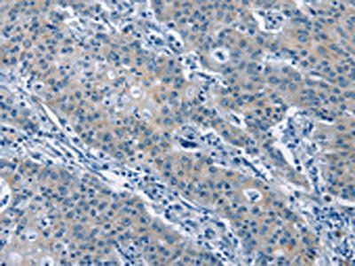 GAS2 Antibody