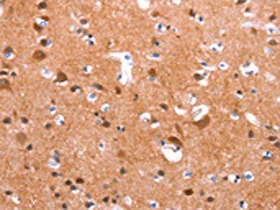 GAS8 Antibody