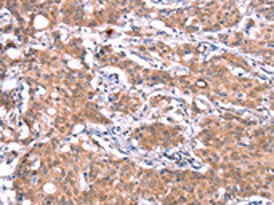 GAS8 Antibody