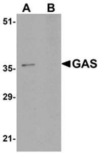 GAS Antibody