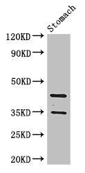 Gastricsin antibody