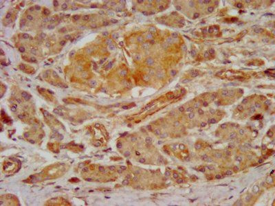 GRPR Antibody
