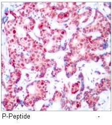 GATA1 (Phospho-Ser142) Antibody