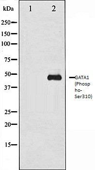 GATA1 (Phospho-Ser310) antibody