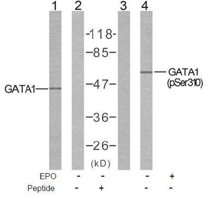 GATA1 (Phospho-Ser310) Antibody