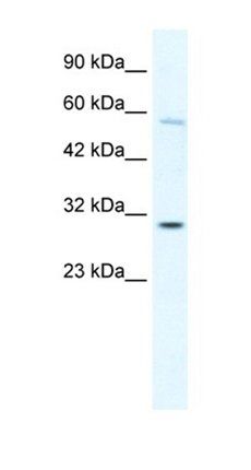 GATAD1 antibody