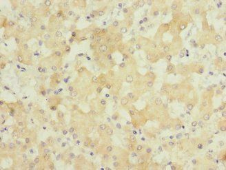 GATC Antibody