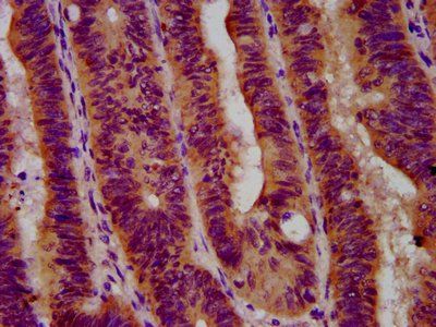GBA Antibody