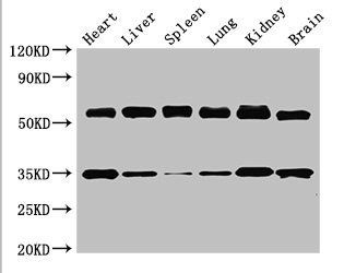 Gba antibody