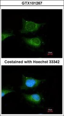 GBA antibody [C1C3]