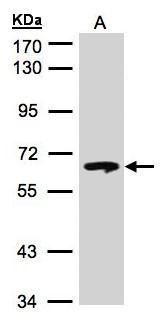 GBA Rabbit Polyclonal Antibody