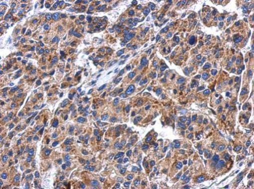 GBA antibody