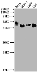 GBA Recombinant Monoclonal Antibody