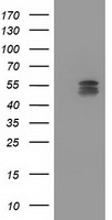 GBA3 antibody