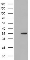GBE1 Antibody