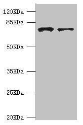 GBE1 Antibody