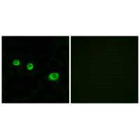 GBP1 Antibody