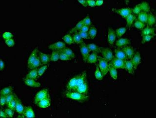 GBP2 antibody