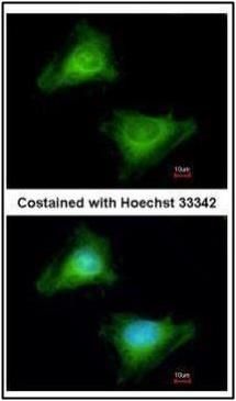 GBP3 Rabbit Polyclonal Antibody