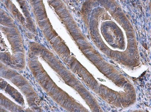 GBP3 Rabbit Polyclonal Antibody