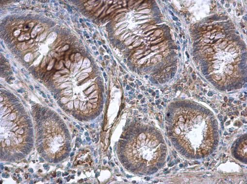 GBP3 Rabbit Polyclonal Antibody