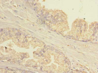 GBP5 antibody