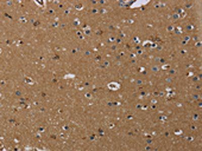 GBP5 Antibody