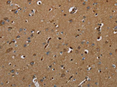 GBP5 Antibody