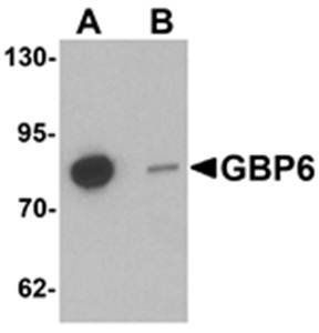 GBP6 Antibody