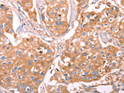 GC Antibody