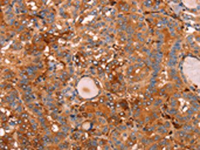 GC Antibody