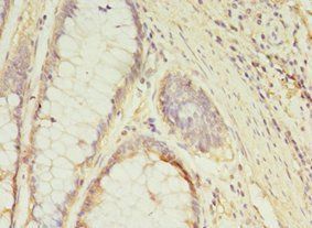 GCC1 Antibody