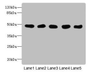 GCDH Antibody