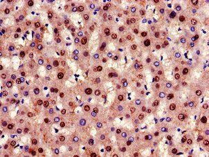 GCGR Antibody