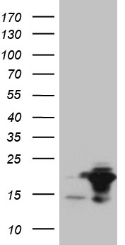 GCIP interacting protein p29 Antibody