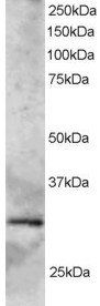 Goat anti-GCIP-interacting protein p29 Antibody
