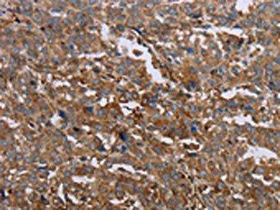 GCK Antibody