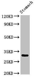 GCLM antibody